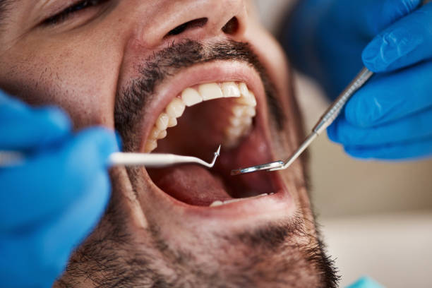 Best Emergency Tooth Extraction in Wolfforth, TX