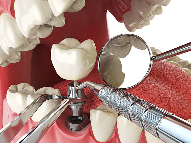 Best Emergency Treatment for Toothache in Wolfforth, TX