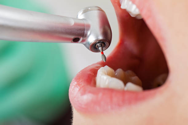 Best Emergency Root Canal Treatment in Wolfforth, TX